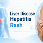 Liver disease hepatitis rash
