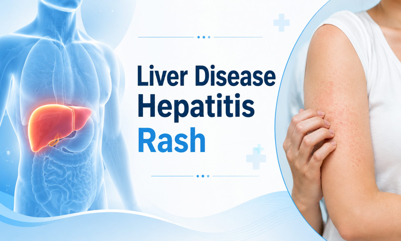 Liver disease hepatitis rash