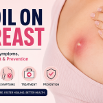 boil on breast