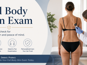 embarrassing full body skin exam