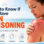 how to know if you have sun poisoning